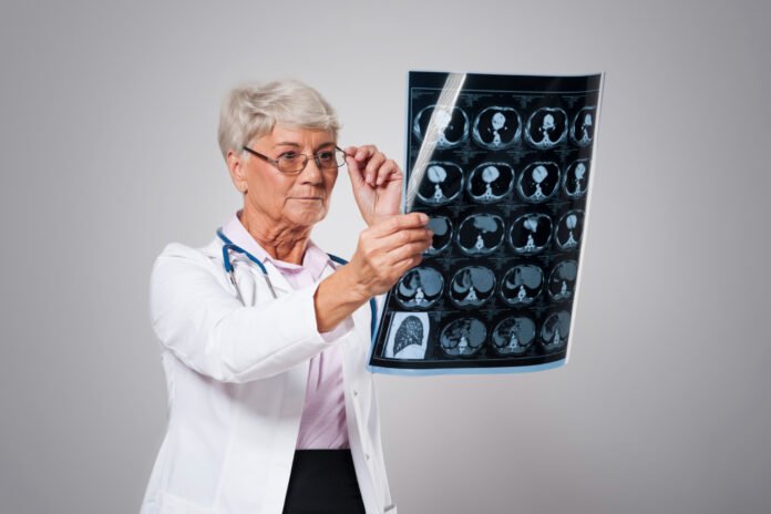especialista analisando uma imagem de diagnostico do cerebro.