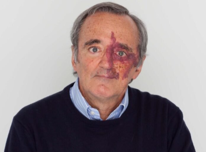 fonte das imagem: Centro Nacional de Investigaciones Oncológicas (CNIO).